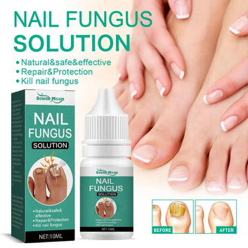 Extra Strong Nail Fungus Treatment Serum